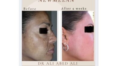 newmelan pigmentation الحل الأنسب لمعالجة تصبّغات الوجه مدى الحياة حديث مع دكتور التجميل ali abedali