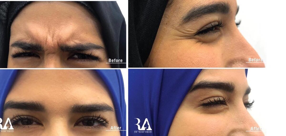 صورة مميزة: حوار مع دكتور الأمراض الجلديَّة والتّجميل رامي عبادي