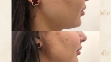 مركز Dermanda Clinic التجميلي ريادة في تقديم العلاجات الآمنة للمشاكل الجلدية