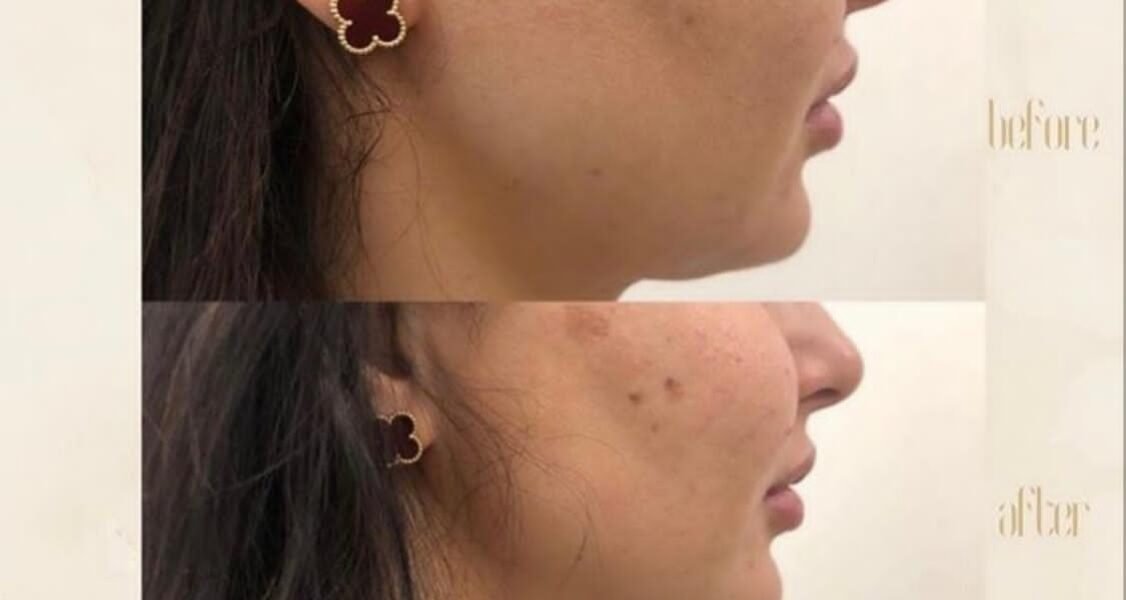 مركز Dermanda Clinic التجميلي ريادة في تقديم العلاجات الآمنة للمشاكل الجلدية - صورة مميزة صورة مميزة: مركز Dermanda Clinic التجميلي ريادة في تقديم العلاجات الآمنة للمشاكل الجلدية